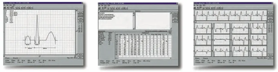 Universal ECG Testing Equipment